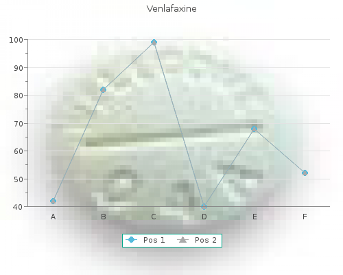 purchase 150 mg venlafaxine fast delivery